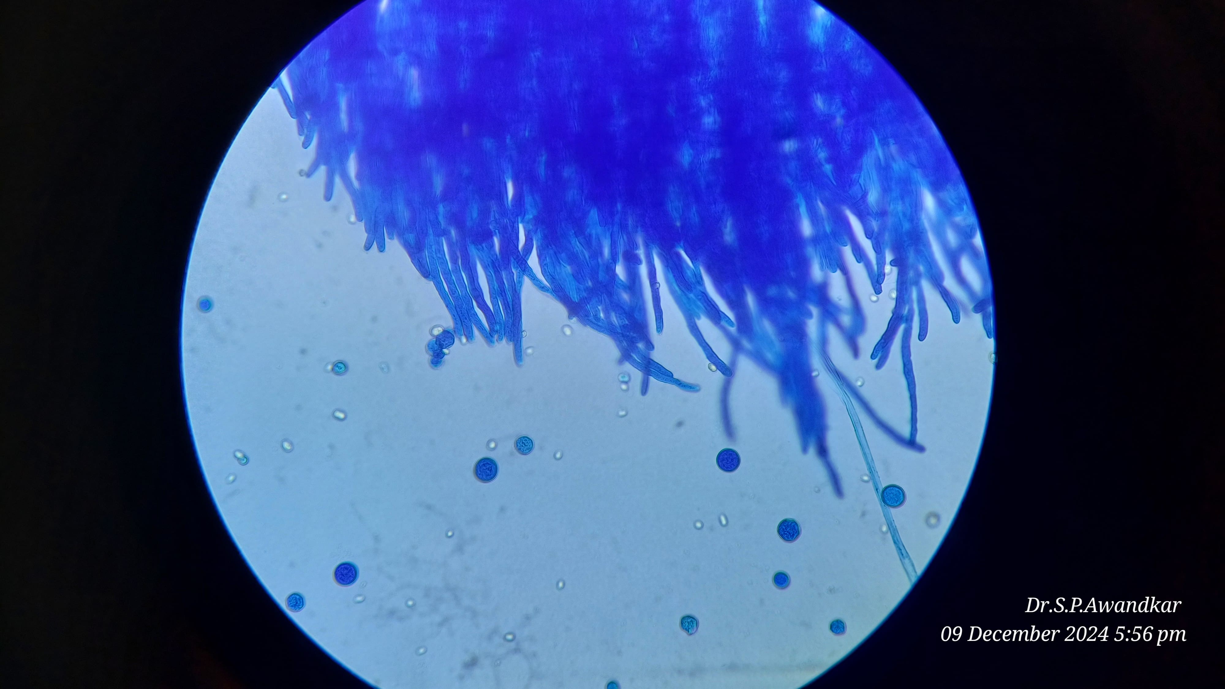 42. Basidiobolus Microscopic